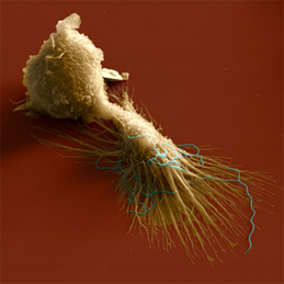 Borrelia burgdorferi